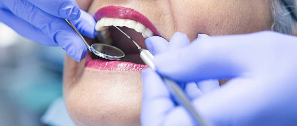 Best Emergency Tooth Extraction in Claxton, GA
